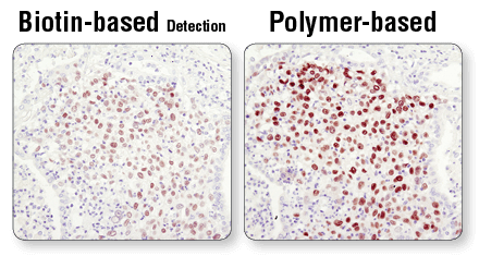 IHC Polymer-based Detection